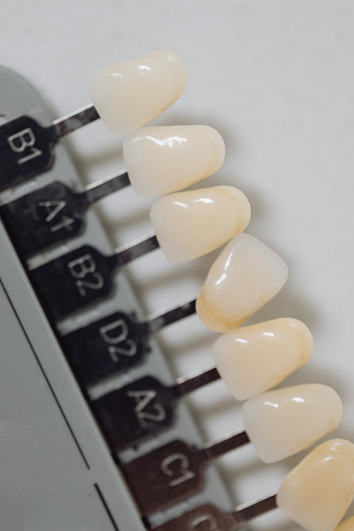 High-quality image of a dental veneers shade guide used in dentistry.